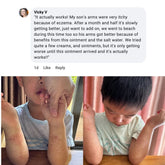 Sven’s Island New Zealand Miracle Manuka - Skin Repair Ointment 17g Eczema Cream